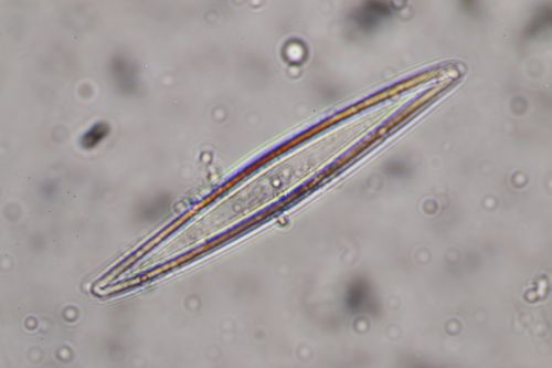 Diatom, Compound Microscope